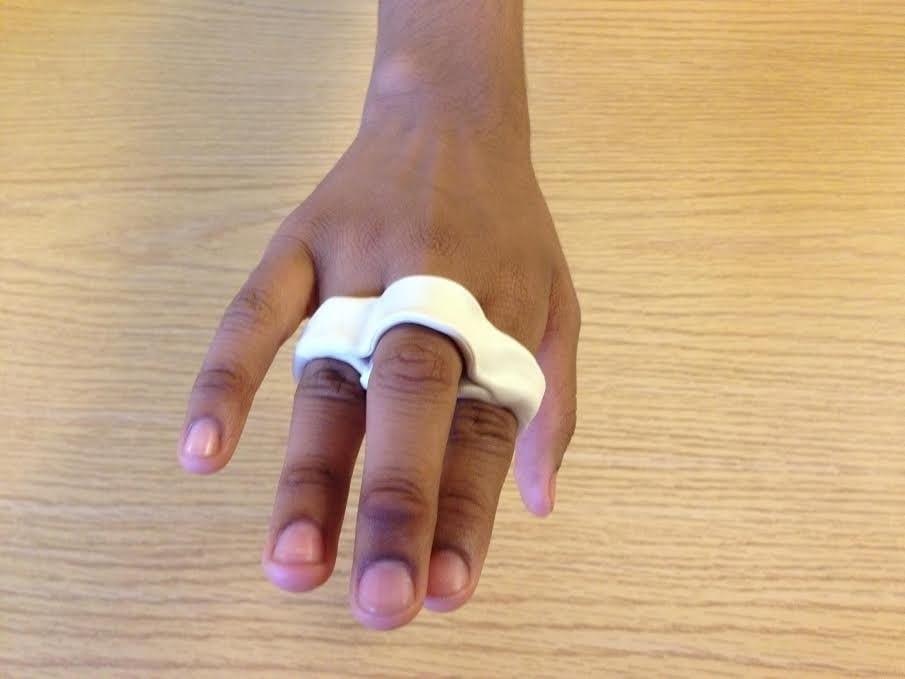 Precision Rehab, Occupational, Physical & Hand Therapy, P.L.L.C. | Plantar Fascitis, Hand Injuries and Neurological Conditions