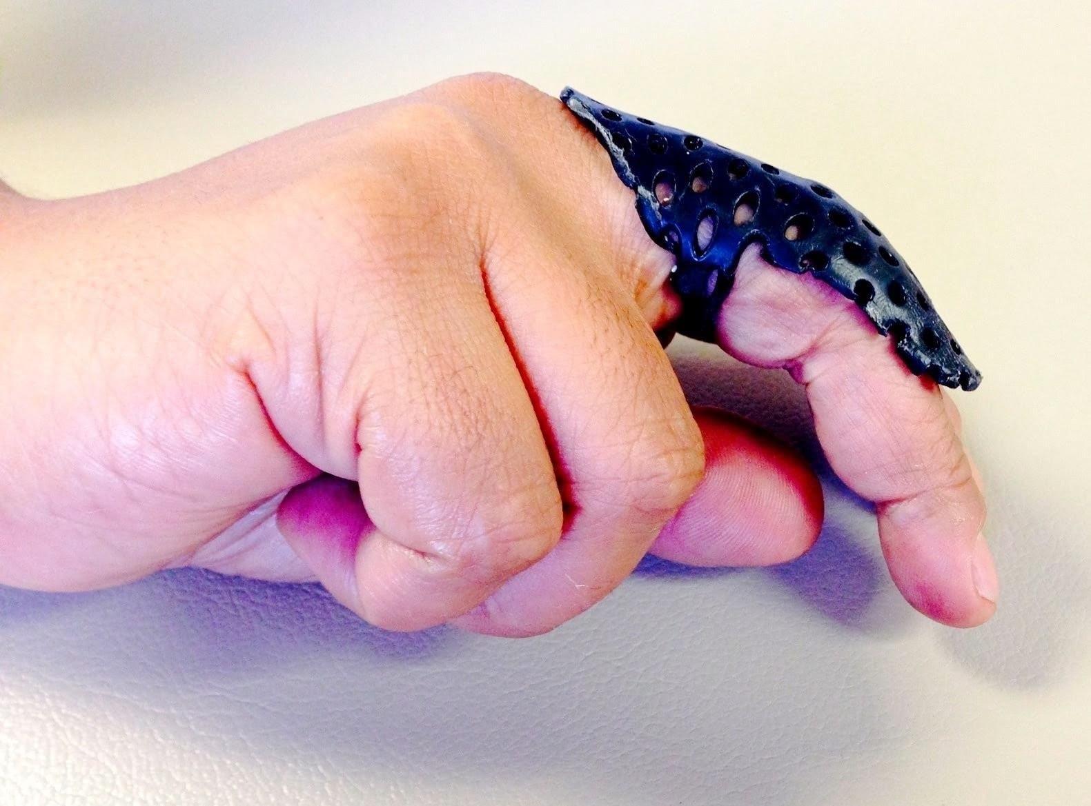 Precision Rehab, Occupational, Physical & Hand Therapy, P.L.L.C. | Tendon Repairs, Strength Training and Carpal Tunnel