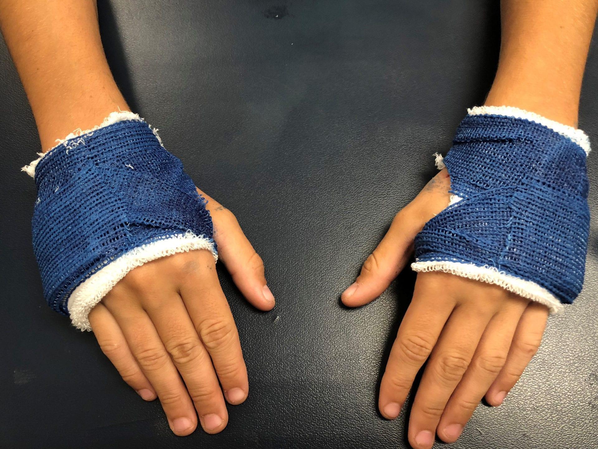 Precision Rehab, Occupational, Physical & Hand Therapy, P.L.L.C. | Shockwave, TMJ and Plantar Fascitis