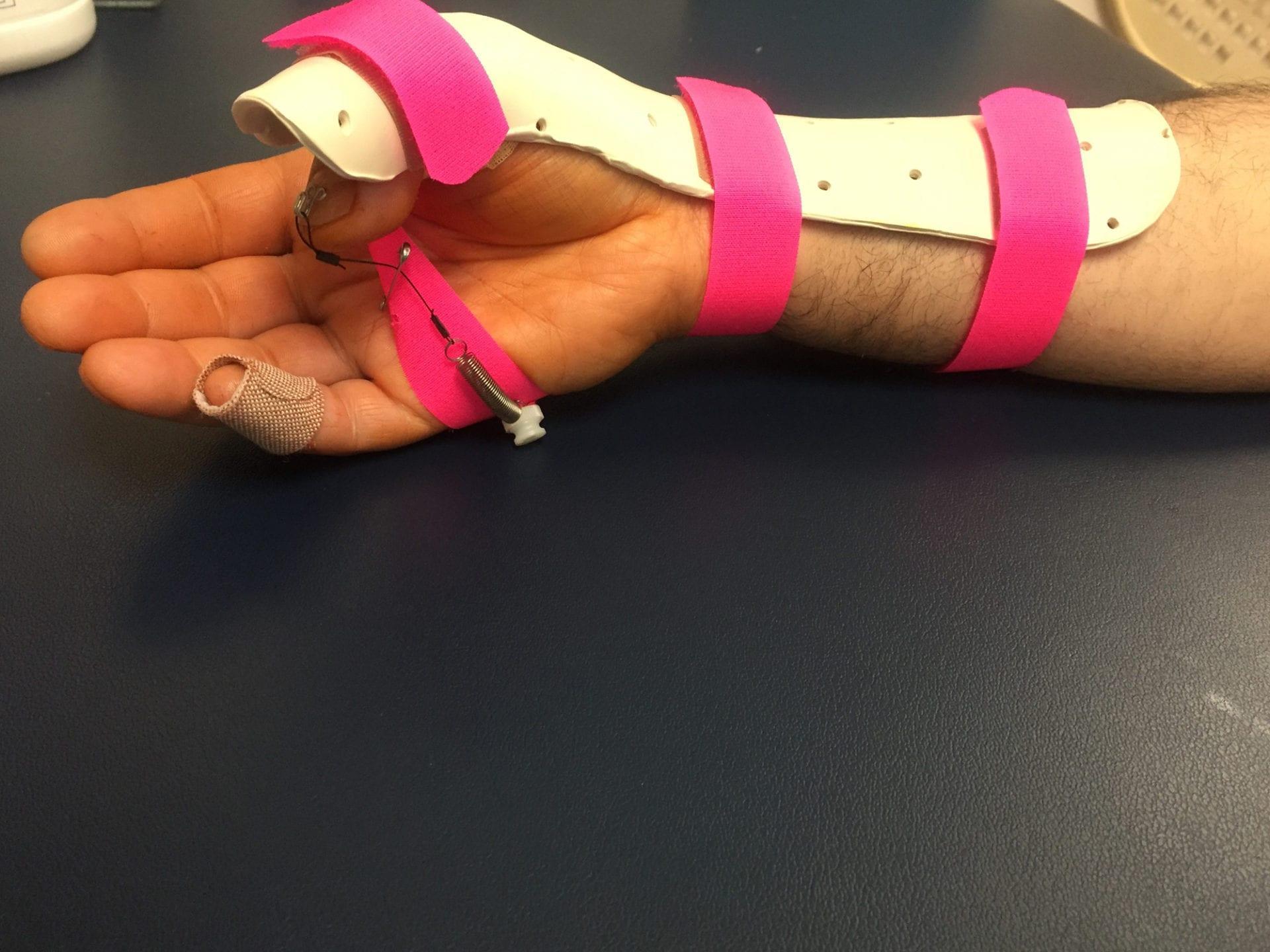 Precision Rehab, Occupational, Physical & Hand Therapy, P.L.L.C. | Osteoporosis, Plantar Fascitis and Back Pain