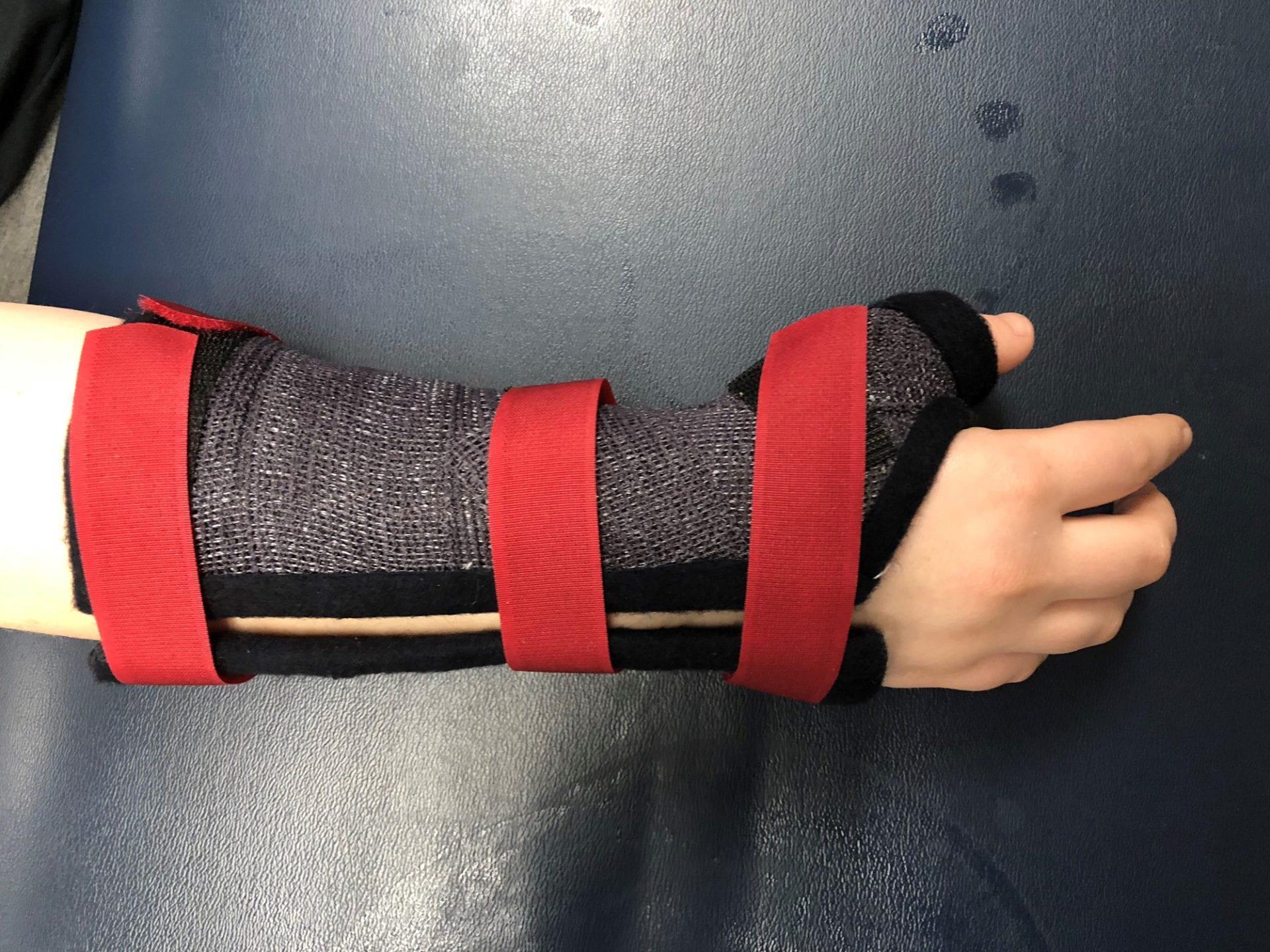 Precision Rehab, Occupational, Physical   Hand Therapy, P.L.L.C. | TMJ, Carpal Tunnel and Hand Injuries