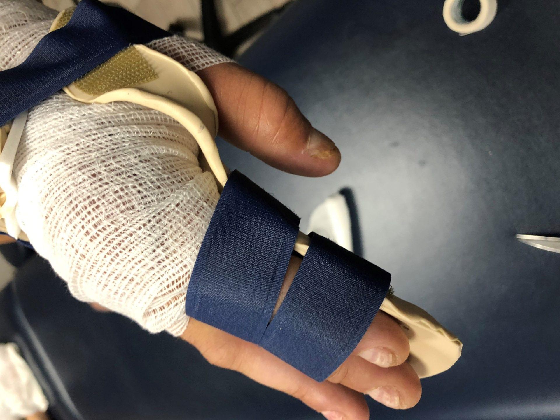 Precision Rehab, Occupational, Physical   Hand Therapy, P.L.L.C. | Custom Splinting, Fibromyalgia and Frozen Shoulder