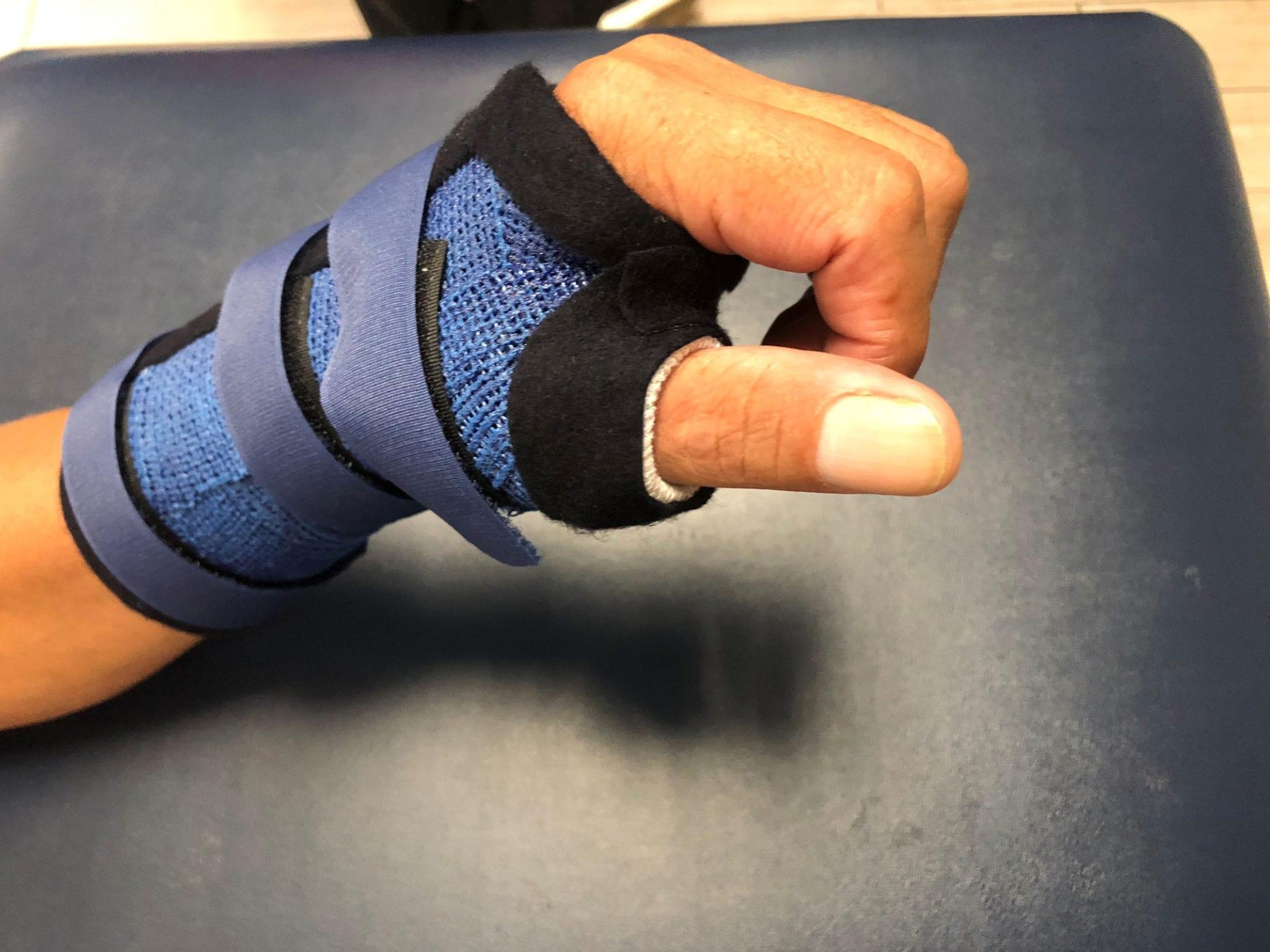 Precision Rehab, Occupational, Physical & Hand Therapy, P.L.L.C. | Custom Splinting, Hand Injuries and Parkinson's Disease