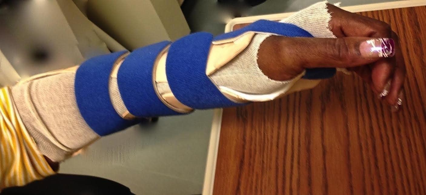 Precision Rehab, Occupational, Physical   Hand Therapy, P.L.L.C. | Fibromyalgia, Laser Therapy and Carpal Tunnel