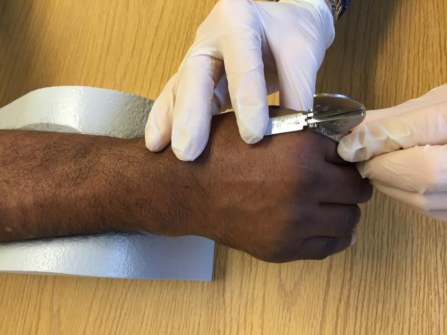 Precision Rehab, Occupational, Physical   Hand Therapy, P.L.L.C. | TMJ, Carpal Tunnel and Neck Pain