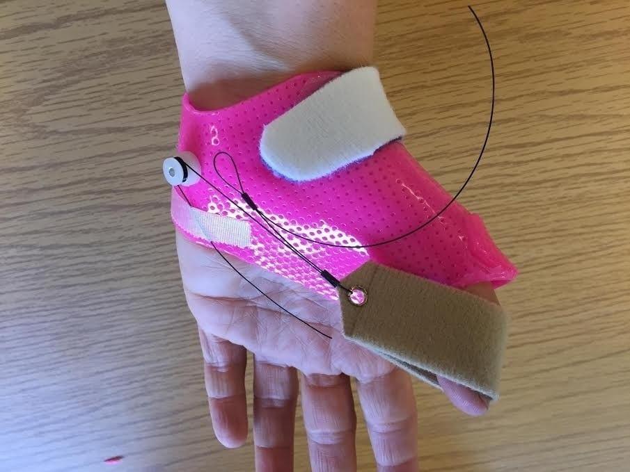 Precision Rehab, Occupational, Physical   Hand Therapy, P.L.L.C. | Osteoporosis, Tendon Repairs and TMJ